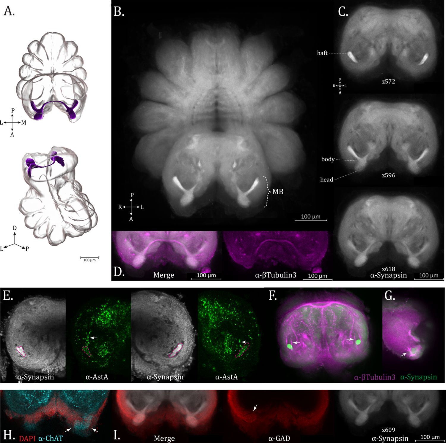 Figure 7. Mushroom bodies (MBs).