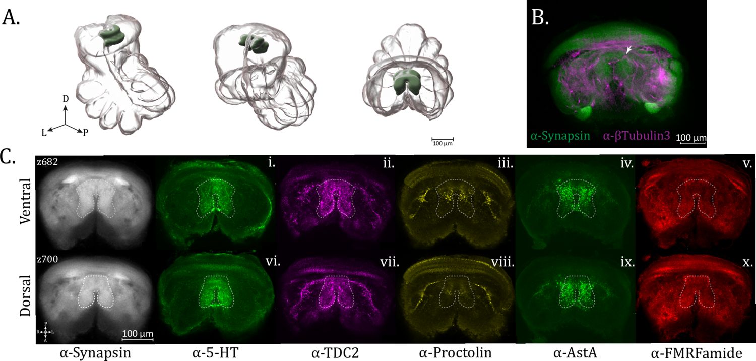 Figure 9. Tonsillar neuropil.