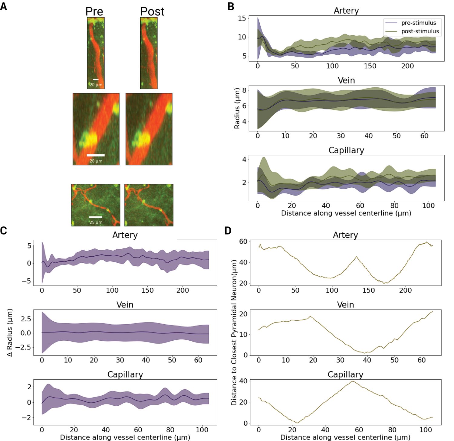 Figure 7. Vertex-wise radii along vessel lengths of a sample artery, capillary, and venule at baseline vs. post-stimulation.